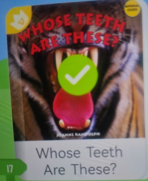 whose teeth are these