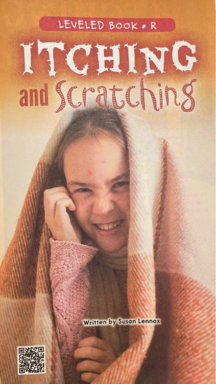 Itching and scratching Raz R