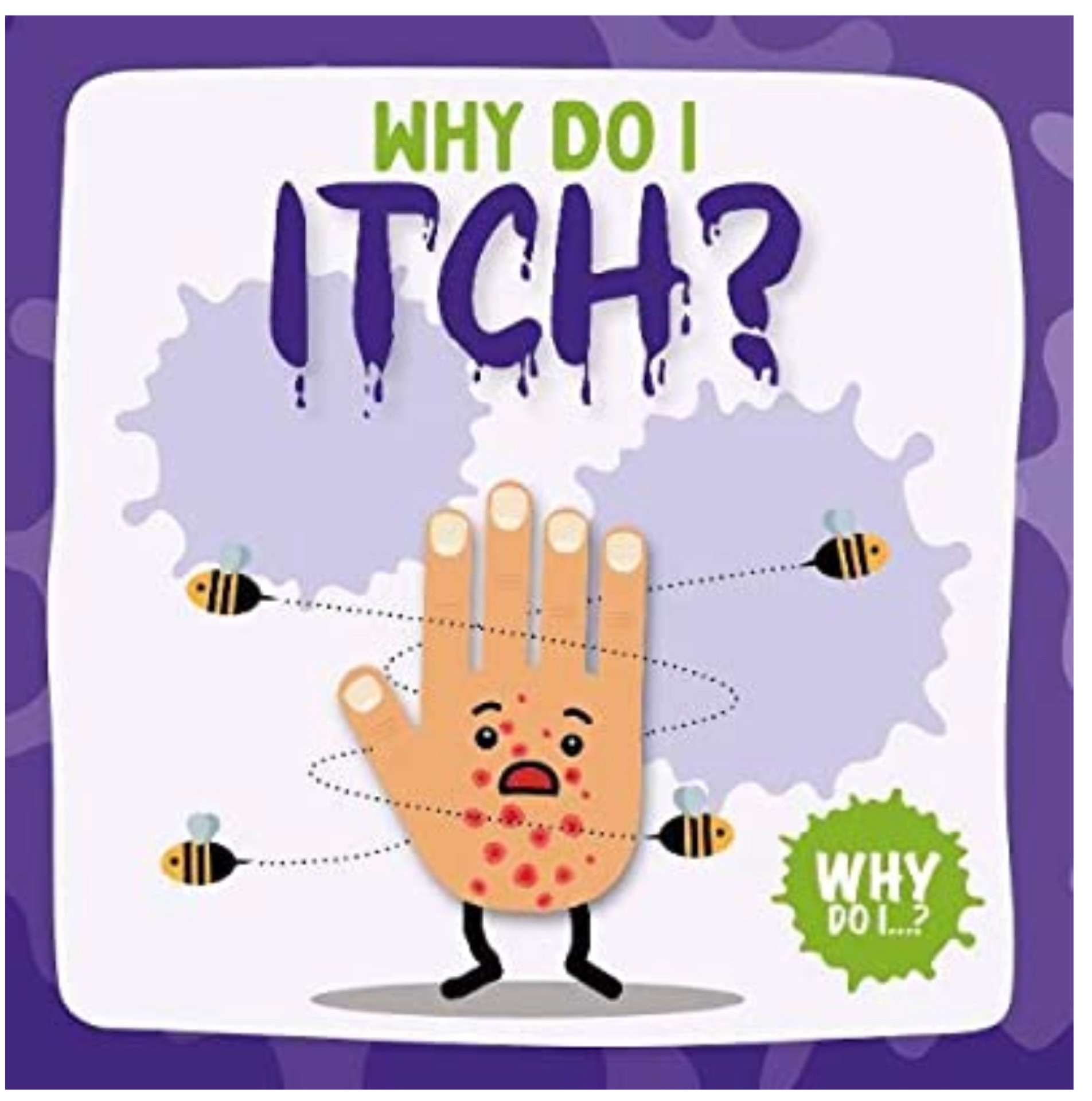 Why do I itch?