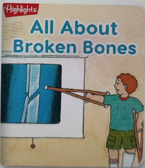 all about broken bones