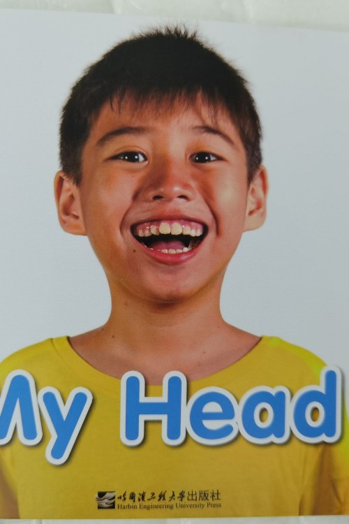 My Head