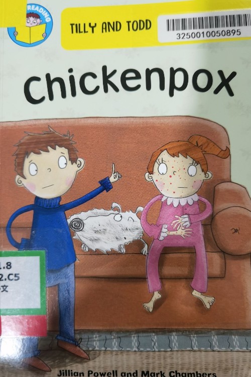 Chickenpox