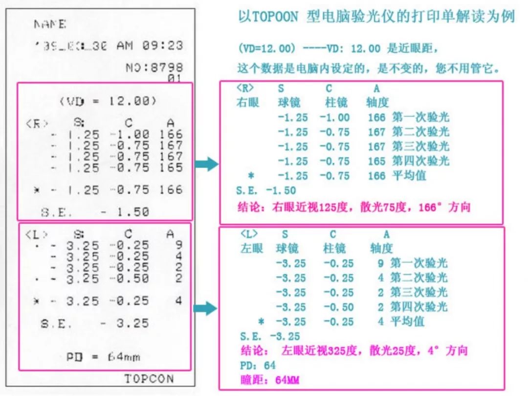 如何看懂驗(yàn)光單