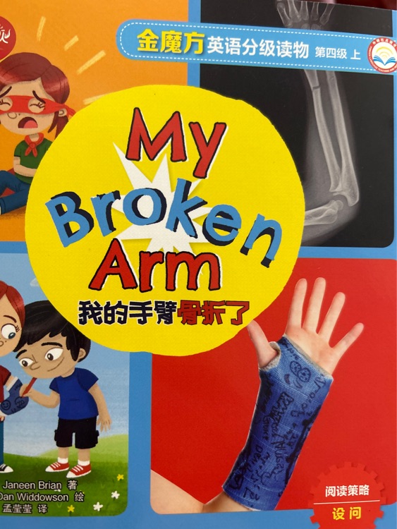 my broken arm