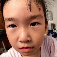 ECHO201811
