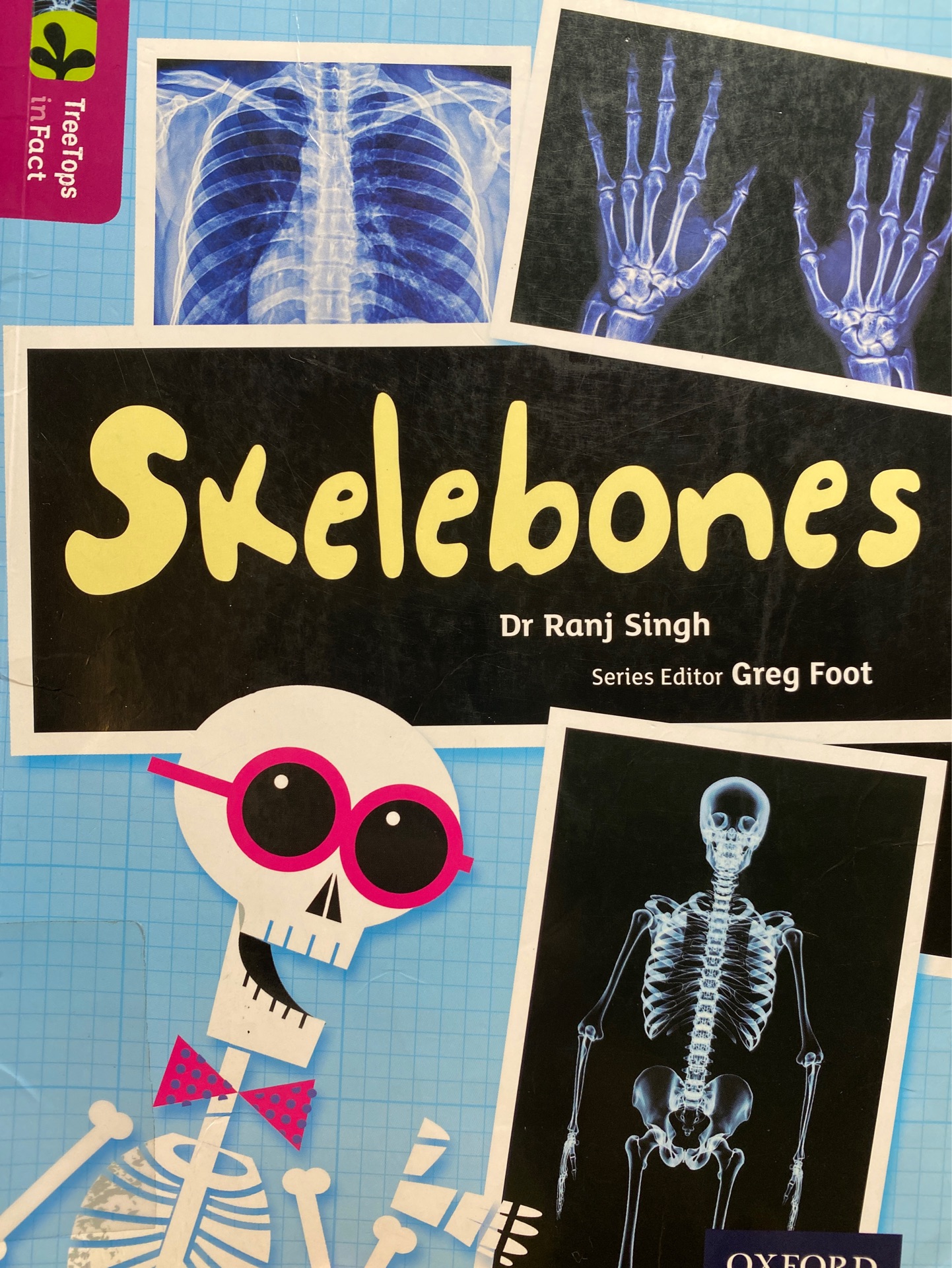 Skelebones