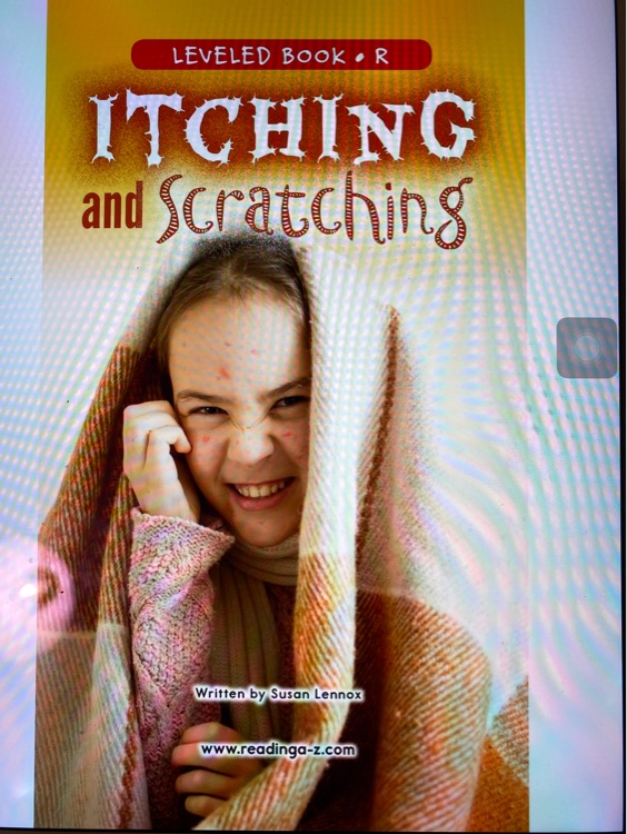 Itching and Scratching(RAZ R)