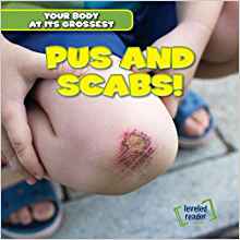 Pus and Scabs! (Your Body at Its Grossest)