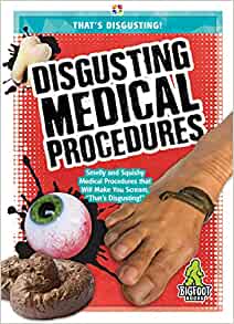 Disgusting Medical Procedures (That?s Disgusting!)