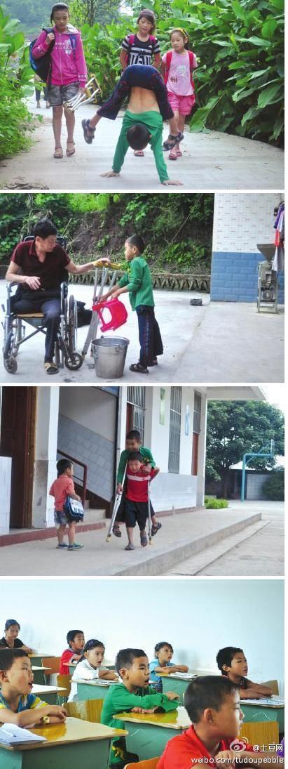 10歲男孩下身癱瘓