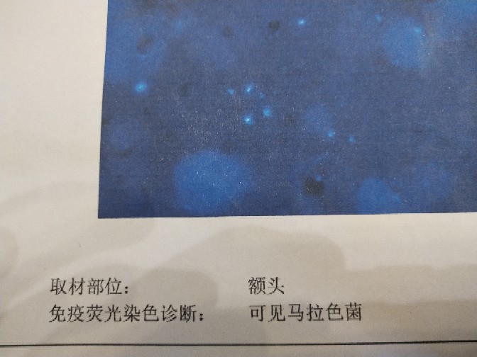 戰(zhàn)痘2